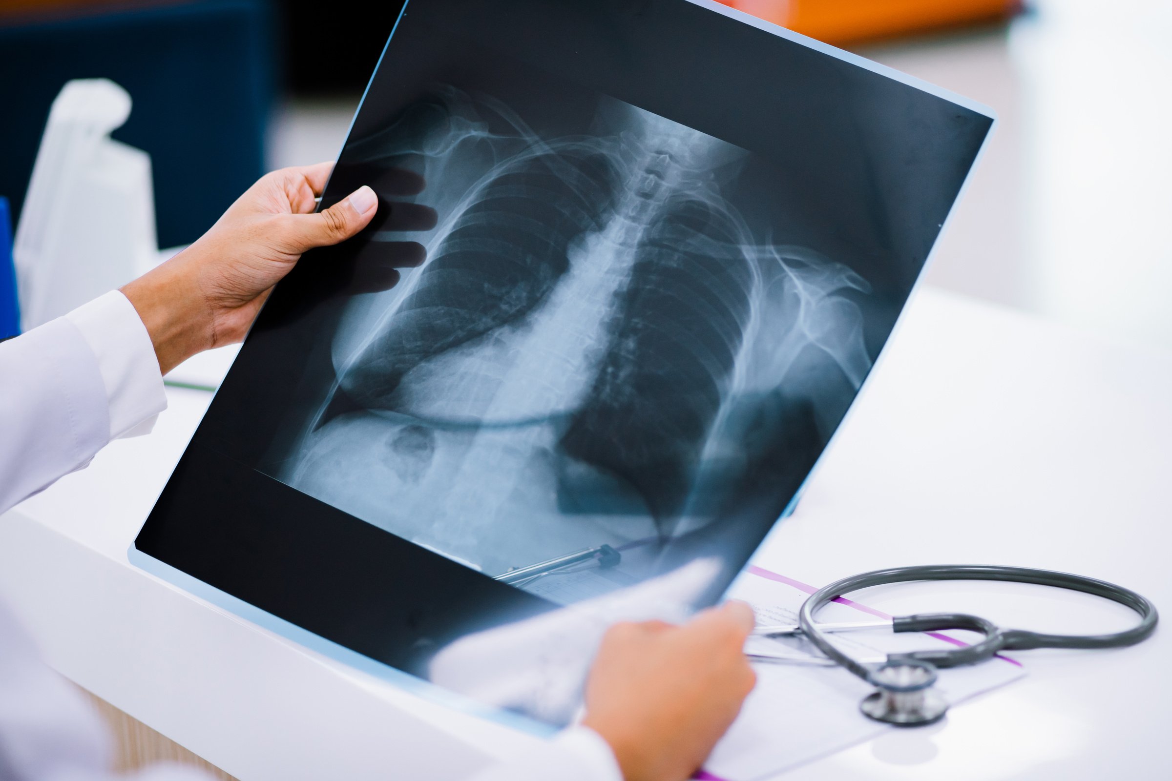 Doctor Examining Chest X Ray